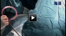 Single Use Wound Protector WPB that can be used on Open abdominal surgery,Cesarean sec